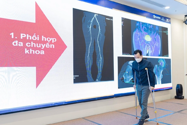 10 ngày sau ca mổ đặc biệt, bệnh nhân ung thư xương đi lại được