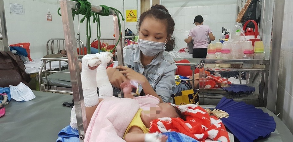 Bé 4 tháng tuổi nghi bị cha bạo hành gãy chân, xuất huyết não - 1 Bé 4 tháng tuổi nghi bị cha bạo hành gãy chân, xuất huyết não - 1
