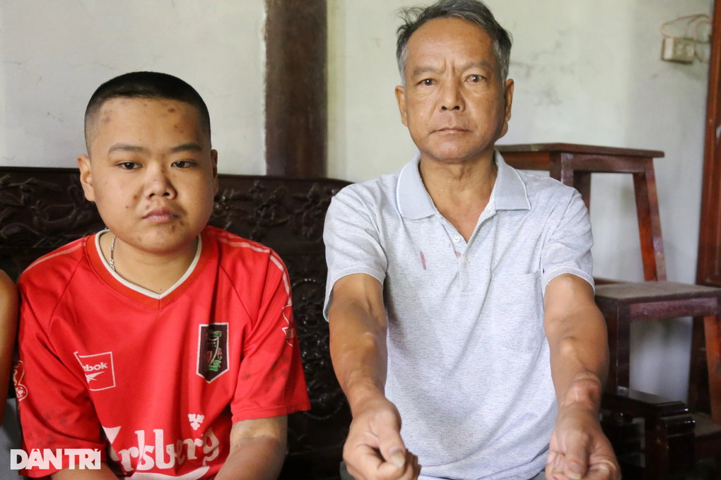 Khốn cùng người phụ nữ gánh 4 người thân bệnh tật - 2 Khốn cùng người phụ nữ gánh 4 người thân bệnh tật - 2