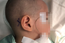 Bé trai 2 tuổi vừa bị máu khó đông, vừa mắc căn bệnh "không thể giật mình"