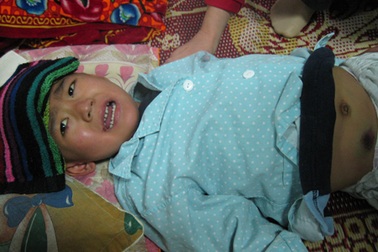 Bé Lê Tuấn Thành đã từ giã cõi đời