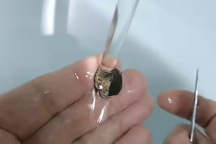 Người đàn ông mắc kẹt đồng xu trong mũi suốt 50 năm