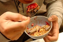 U sán ở mắt vì ăn tiết canh lợn