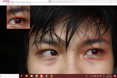 Đại sứ kỹ năng nghề giúp người thực vật giao tiếp bằng mắt