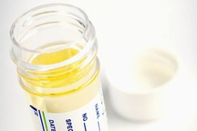 Xét nghiệm tại nhà phát hiện sớm ung thư tuyến tiền liệt