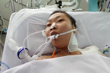 Cô giáo trẻ nguy kịch vì một vết ong chích