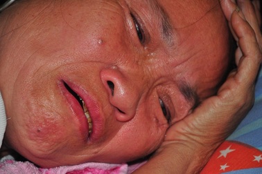 Mẹ nằm liệt giường khóc nghẹn thương con bị ung thư hạch không tiền đi viện