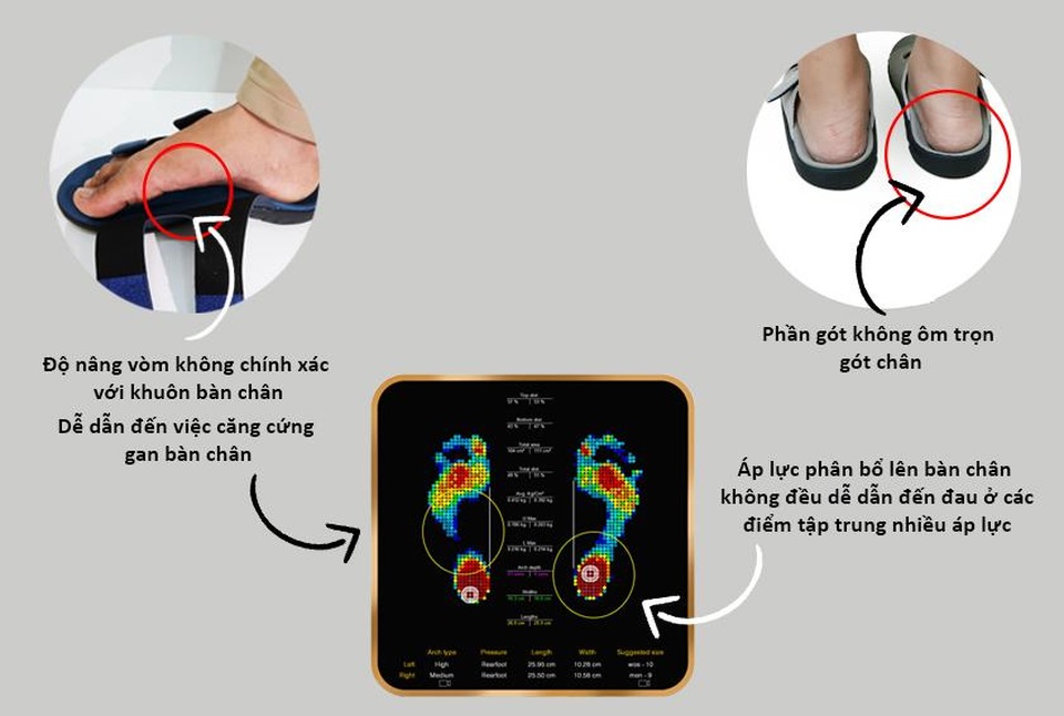 Hậu quả khi sử dụng giày dép chỉnh hình chân bẹt kém chất lượng và tác hại khôn lường - 2 Hậu quả khi sử dụng giày dép chỉnh hình chân bẹt kém chất lượng và tác hại khôn lường - 2