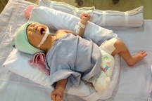 Vụ thai nhi bị xe cán văng khỏi bụng mẹ: Bộ trưởng Y tế gửi thư khen bệnh viện Nhi Đồng 1