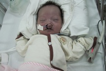 Bé trai dị dạng khát khao bàn tay mẹ