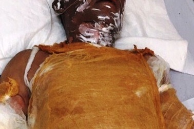 Người đàn ông biến thành ngọn đuốc sống vì bị tẩm xăng đốt