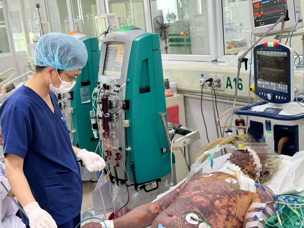 Liên tiếp trường hợp nguy kịch, phải cắt ngón vì bệnh từ lợn - 1 Liên tiếp trường hợp nguy kịch, phải cắt ngón vì bệnh từ lợn - 1