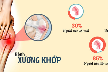 Dinh dưỡng bảo vệ xương và sụn khớp chuẩn Hoa Kỳ