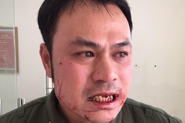 ​Nhân viên an ninh sân bay Nội Bài bị đối tượng cò mồi taxi dù hành hung