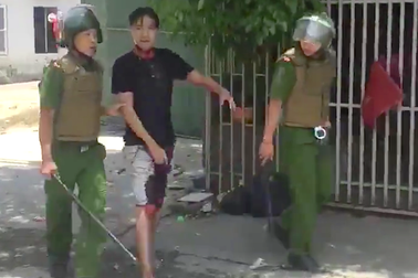 Nam thanh niên “ngáo đá” cầm dao cứa cổ mình chảy máu?