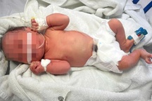 Hà Nội: Bé sơ sinh bị bỏ rơi ở bụi chuối, nhiều vết bầm tím, côn trùng đốt