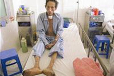 Nhiều người mắc bệnh từ lợn