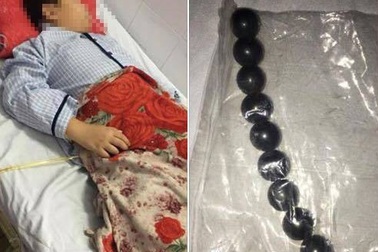 Sẽ làm rõ vụ việc nam sinh lớp 5 bị bạn học ép nuốt 9 viên bi sắt