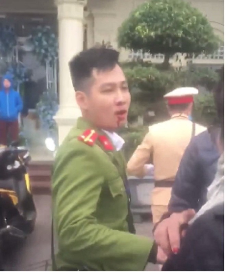 Sau vi phạm giao thông, nam thanh niên đánh chảy máu mũi công an - 1 Sau vi phạm giao thông, nam thanh niên đánh chảy máu mũi công an - 1