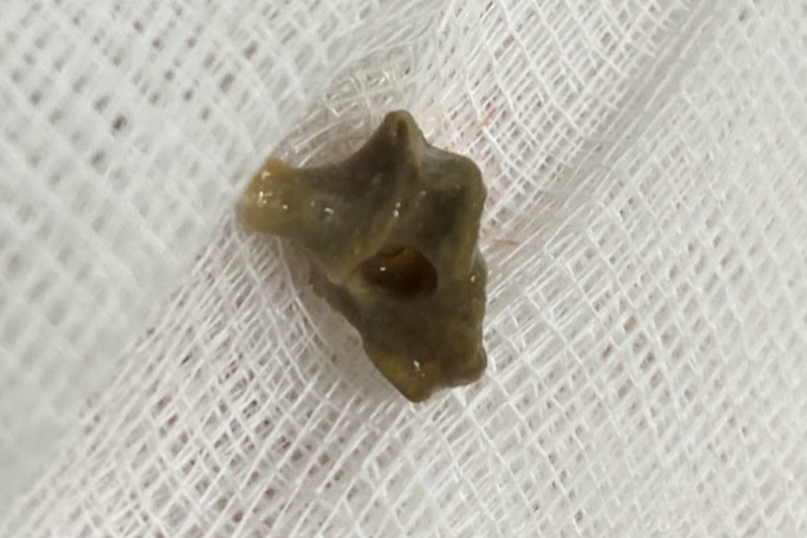 Nuốt vỏ bịch dầu gội đầu trong lúc tắm, người đàn ông tử vong thương tâm - 2 Nuốt vỏ bịch dầu gội đầu trong lúc tắm, người đàn ông tử vong thương tâm - 2