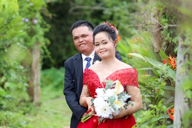 Tình yêu hồi sinh bà mẹ hai con từng bị chồng cũ thiêu sống