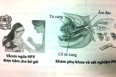 Cấp bách vấn đề dự phòng - điều trị ung thư cổ tử cung