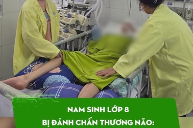 Nam sinh lớp 8 bị đánh chấn thương não: Có chuyển biến tích cực