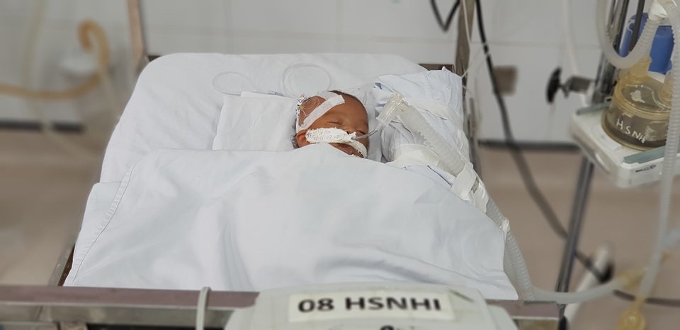 Sự sống mong manh của bé trai bị bỏ rơi hấp hối trong sân chùa - 7 Sự sống mong manh của bé trai bị bỏ rơi hấp hối trong sân chùa - 7