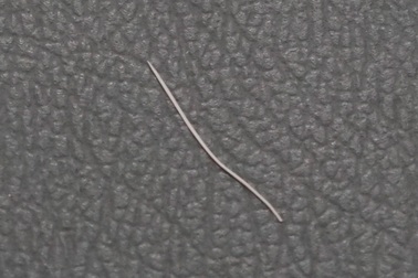 Người đàn ông sưng tấy cổ, phải phẫu thuật chỉ vì... hóc xương cá