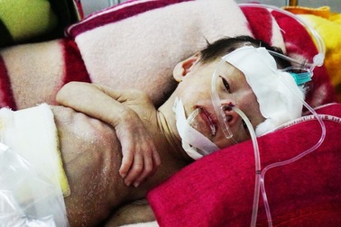 Xót lòng cháu bé chào đời bằng phương pháp thụ tinh ống nghiệm bị đa dị tật