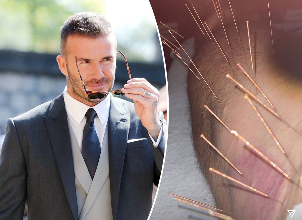 David Beckham tìm tới châm cứu để duy trì phong độ - 1 David Beckham tìm tới châm cứu để duy trì phong độ - 1