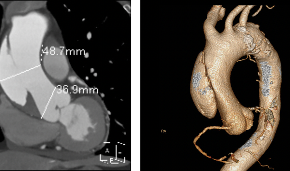 TPHCM: Phát hiện người phụ nữ có nguy cơ đột tử rất cao sau cơn đau ngực - 1 TPHCM: Phát hiện người phụ nữ có nguy cơ đột tử rất cao sau cơn đau ngực - 1