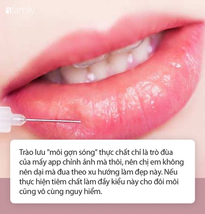 Trào lưu &quot;môi gợn sóng&quot; khiến nhiều chị em đang háo hức có thực sự đáng thử? - Ảnh 4.