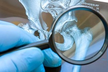 Khó phát hiện sớm ung thư xương, cần cảnh giác nếu cơ thể có dấu hiệu này