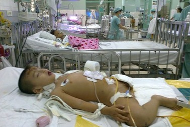 Bé Thiên Bảo chưa thể qua được nguy kịch