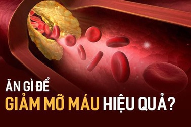 Mỡ máu, mỡ gan ăn thế nào để “tiêu” mỡ nhanh?