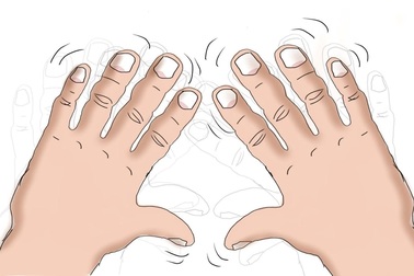 Hy vọng mới giúp bệnh nhân run tay lấy lại tự tin trong cuộc sống