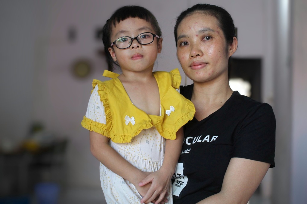 Vợ chồng chiến sĩ hải quân xin bạn đọc cứu đôi mắt của con gái nhỏ - 2 Vợ chồng chiến sĩ hải quân xin bạn đọc cứu đôi mắt của con gái nhỏ - 2