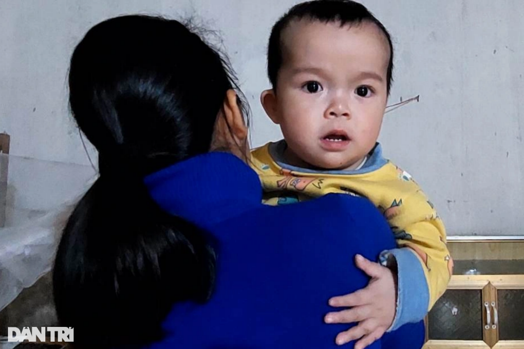 Bé trai 2 tuổi mang 2 căn bệnh hiểm, cha mẹ nghèo đau đớn, bất lực - 1 Bé trai 2 tuổi mang 2 căn bệnh hiểm, cha mẹ nghèo đau đớn, bất lực - 1