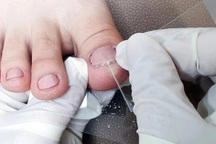 Nắng gay gắt rồi mưa bất chợt, nhiều người phát bệnh da: Đối phó thế nào?