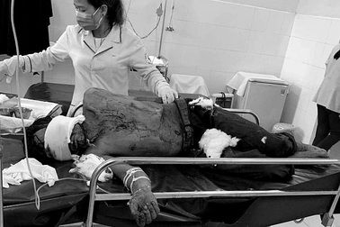 Người đàn ông bị gấu vồ nguy kịch, phải thở máy