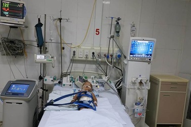 Bé trai 15 tháng tuổi ngừng tuần hoàn do đuối nước được cứu sống