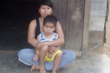 Bé 4 tuổi nguy kịch vì u nguyên bào võng mạc