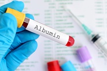 Những phương pháp giúp kiểm tra gan có còn hoạt động tốt