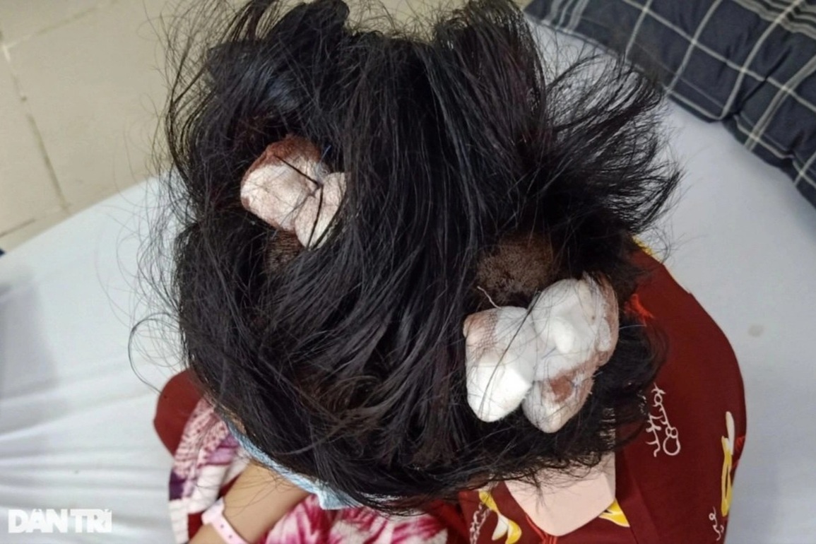 Lời kể của mẹ bé gái 16 tuổi bị cha dượng đánh nhập viện - 1 Lời kể của mẹ bé gái 16 tuổi bị cha dượng đánh nhập viện - 1
