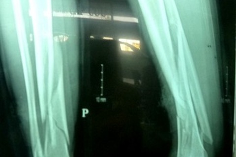 Cảnh báo những tai nạn đáng tiếc trong những ngày cận Tết