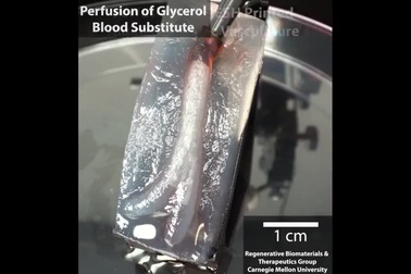 Các nhà khoa học đã in 3D trái tim người với kích thước như tim thật