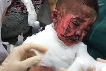 Đốt giấy chơi cháy luôn cả phòng ngủ, 2 cháu nhỏ bỏng toàn thân