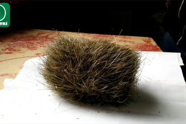 Mổ lợn bán phát hiện "cát lợn" quý hiếm