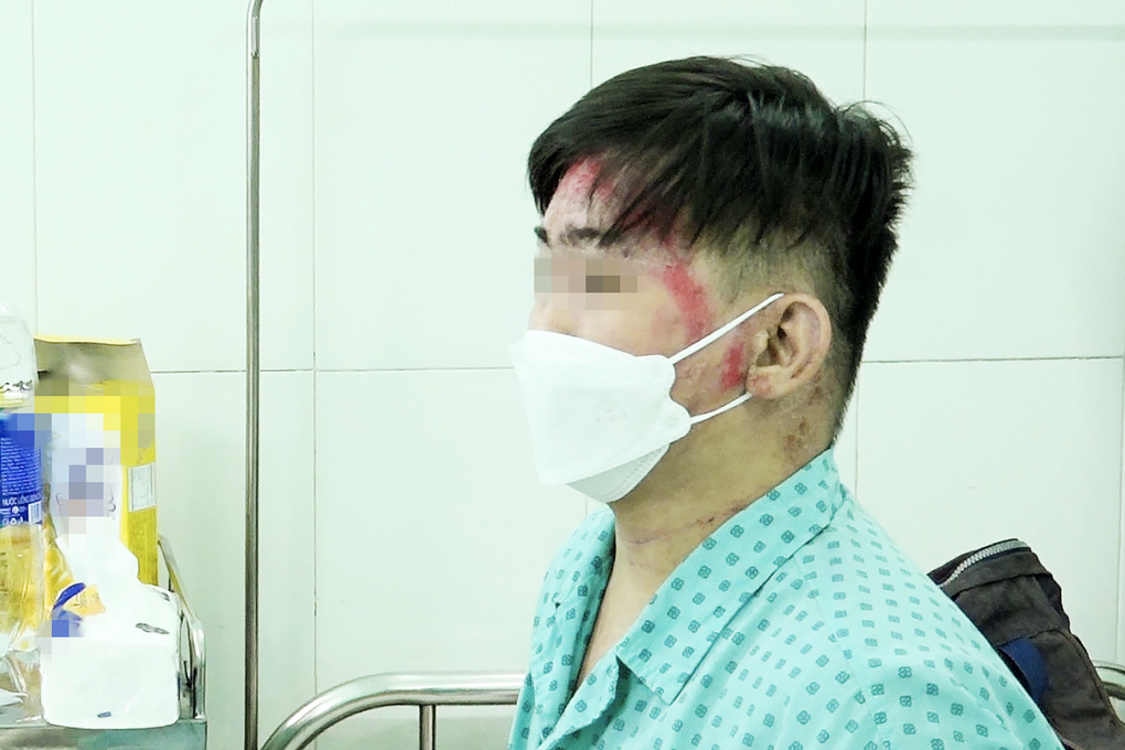 Căn bệnh khiến người đàn ông tự chích tay, chân vì ngứa muốn phát điên - 3